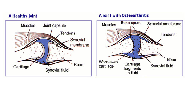 cane corso joints hurt megnagyobbodott nyirokcsomók ízületi fájdalmak során